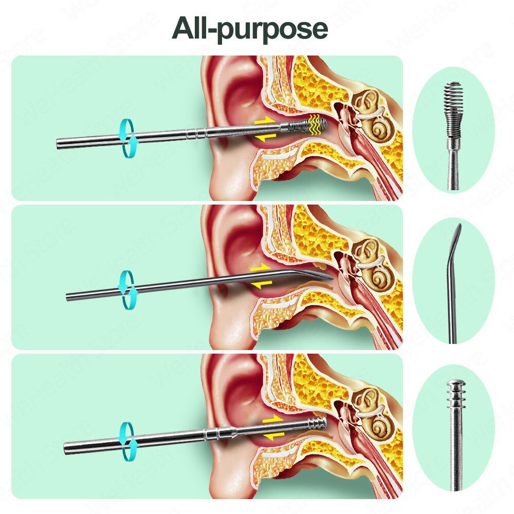 The Most Professional Ear Cleaning Master In 2023— EarWax Cleaner Tool Set